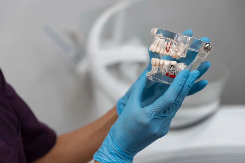 All on 4 – jak wygląda odbudowa całego uśmiechu krok po kroku?